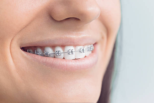 Dental Inlays and Onlays in Everson, WA